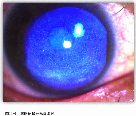 ZY016_52_1.gif